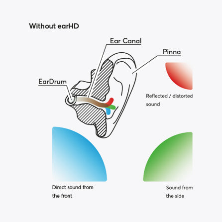 earHD - Upgrade your ears - By Flare Audio by Flare Audio — Kickstarter